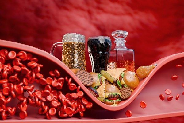 Cholesterol and Lurking Complications