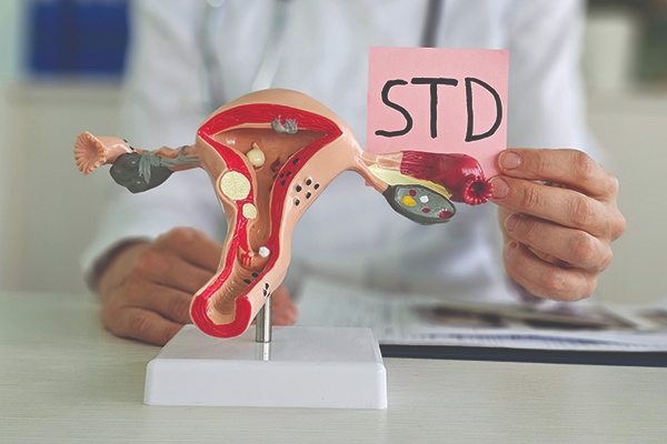 Tests for Sexually Transmitted Diseases