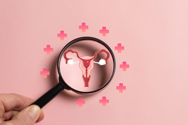 Gejala PCOS Sering Diabaikan: Kapan Harus Periksa?