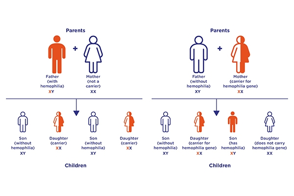 Hemophilia: When Blood Fails To Clot