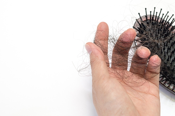 Certain medications or infections can also cause hair loss.