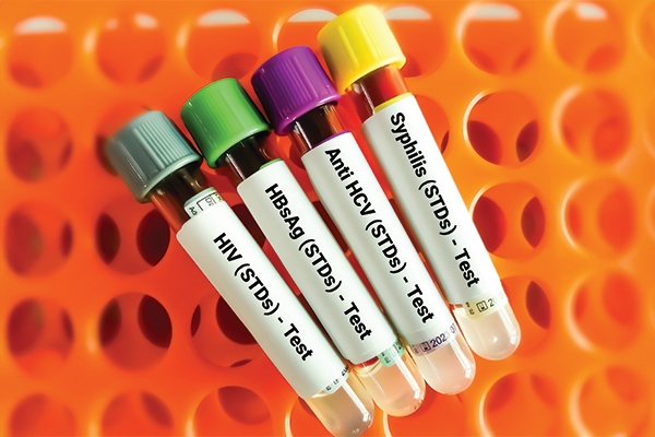 Getting tested early is not only crucial for your health, but it also helps protect your partner from the risk of transmission.