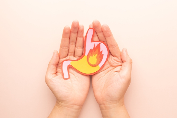 GERD is a condition where stomach acid flows back into the esophagus.