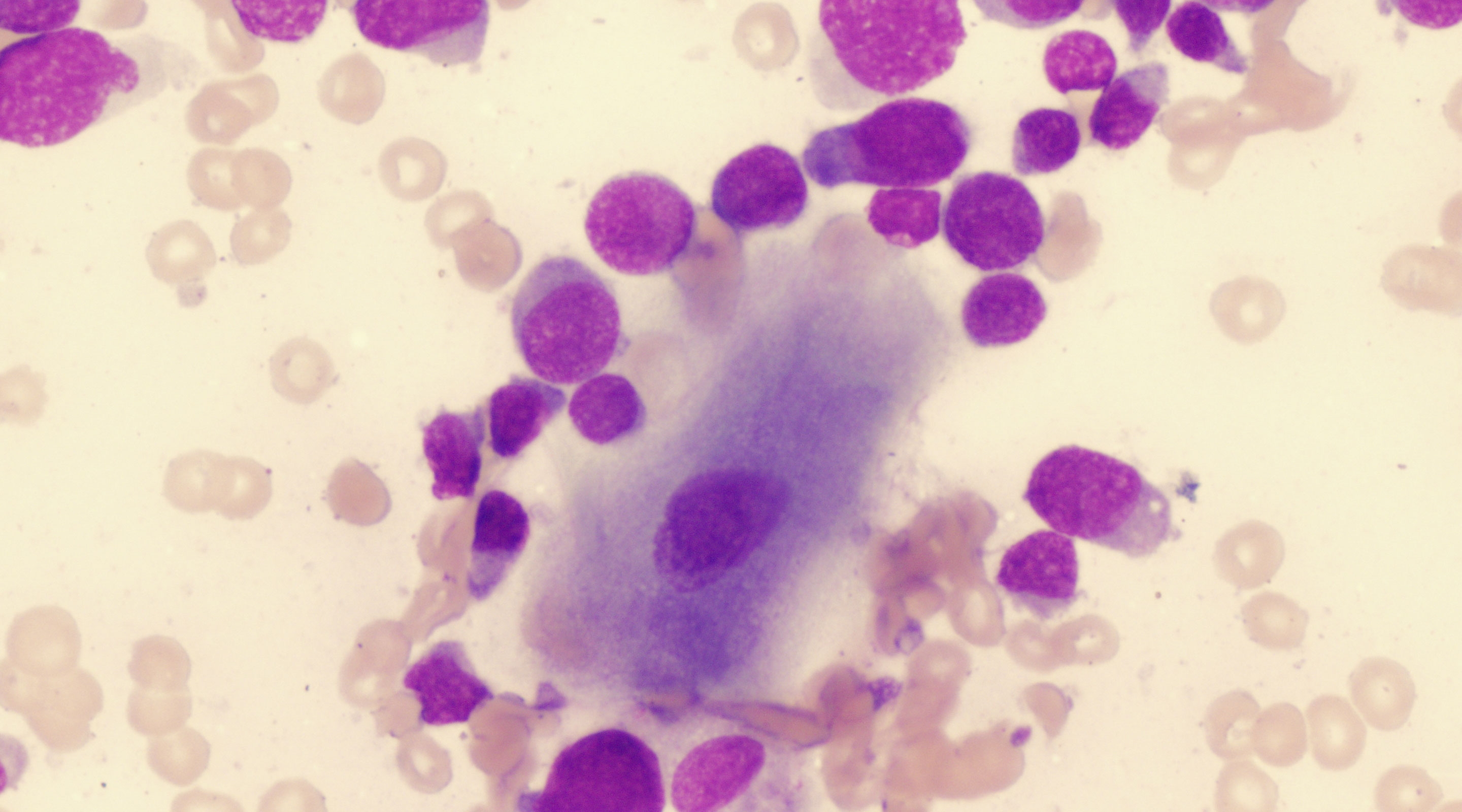 Autologous dendritic cells are safe for therapeutic use.